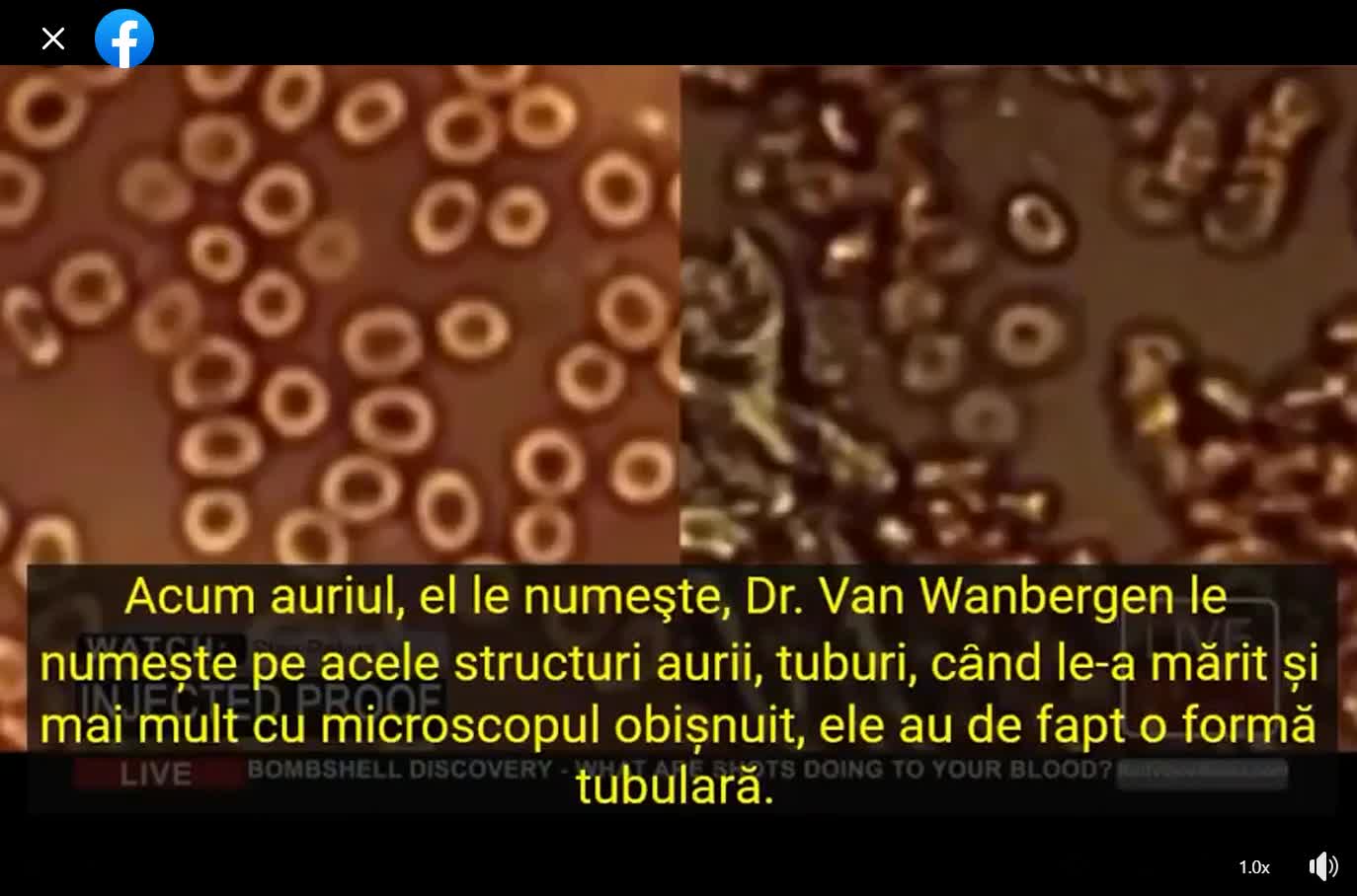 Cum arata sangele celor injectati