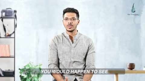 MY LIFE CHANGING 6 MONTHS JOURNEY OF FUE HAIR TRANSPLANT. BEST RESULT JOEL
