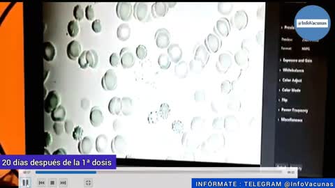 LA SANGRE DE LOS VACUNADOS