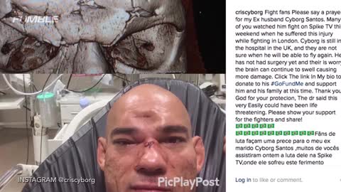 Evangelista 'Cyborg' Santos Has Gruesome Dent In His Head After Bellator Fight