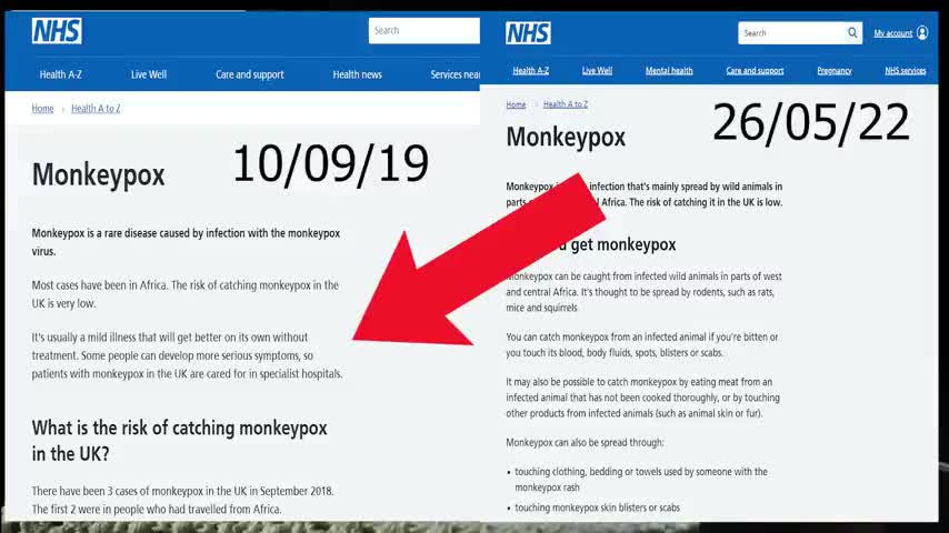 NHS editing monkeypox circus 🎪 page 🚨☠️🚨