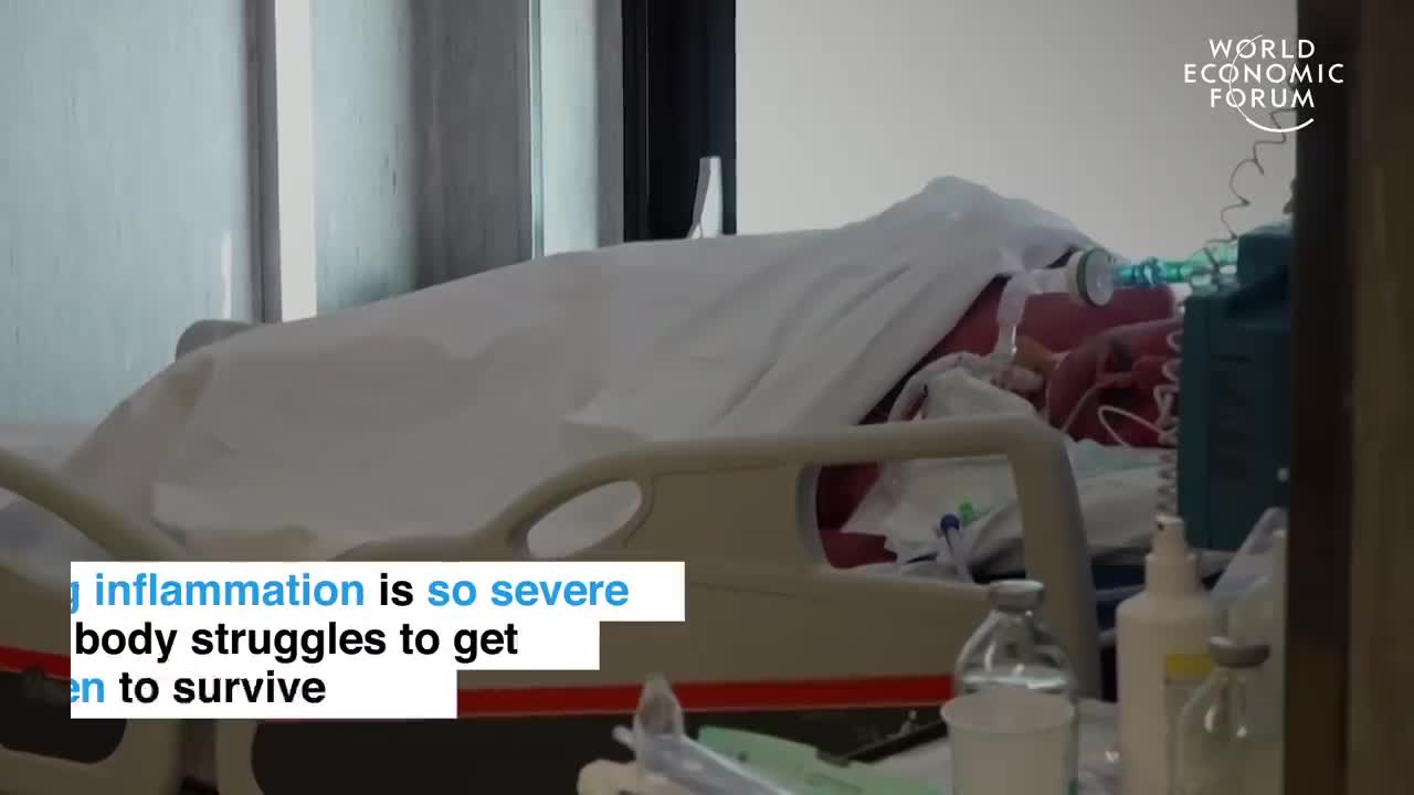 This is what coronavirus does to the body (COVID19)