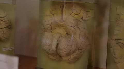 CURIOSIDADES Y COMPLEJIDADES DEL CEREBRO