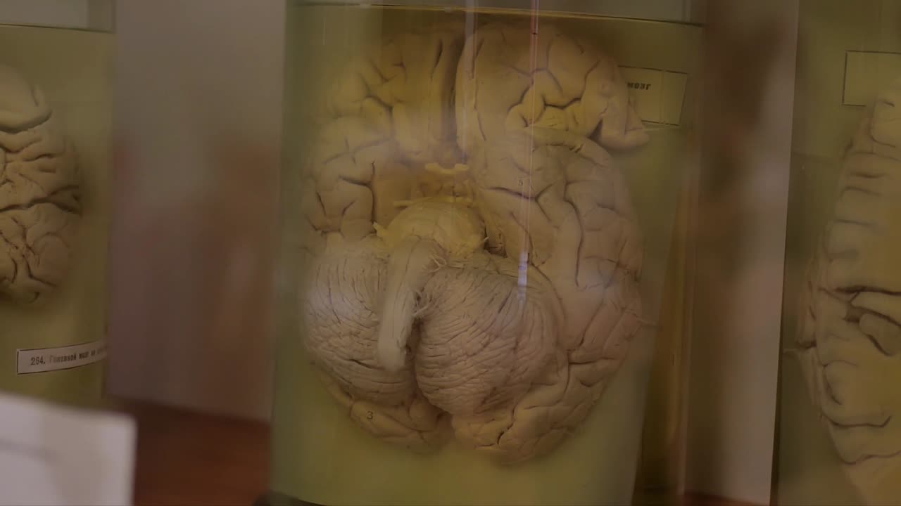 CURIOSIDADES Y COMPLEJIDADES DEL CEREBRO