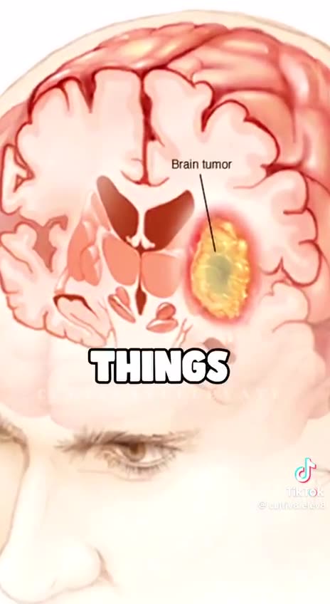 AIRPORT SCANNER RADIATION