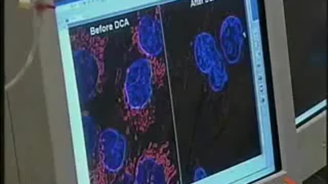 News report on cancer cure dichloroacetate DCA