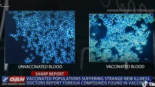 Vaccinated Populations Suffering Strange New Illness