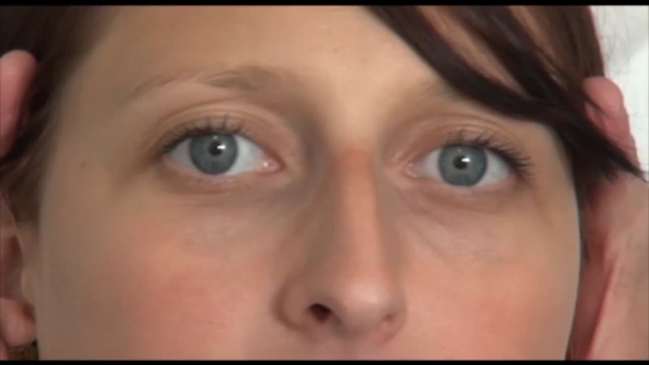 Head impulse test, normal findings