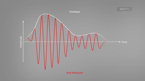 Understanding Sound Waves - MED-EL