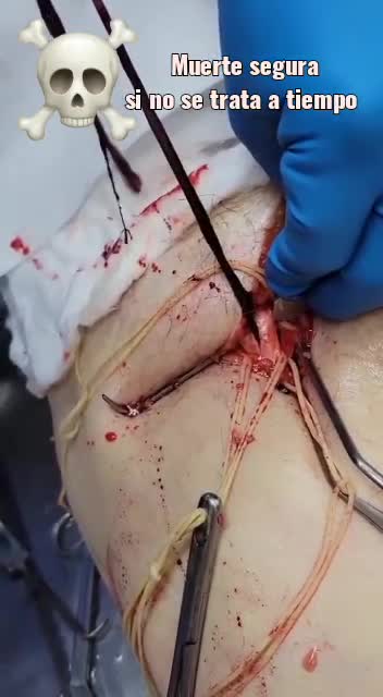 DE LO MÁS NORMAL..... 🤦‍♂️🤦‍♂️🤦‍♂️🤦‍♂️