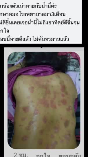 อะไรอยู่ในวัคซีนไฟเซอร์