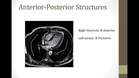 cardiac anatomy bnb videos