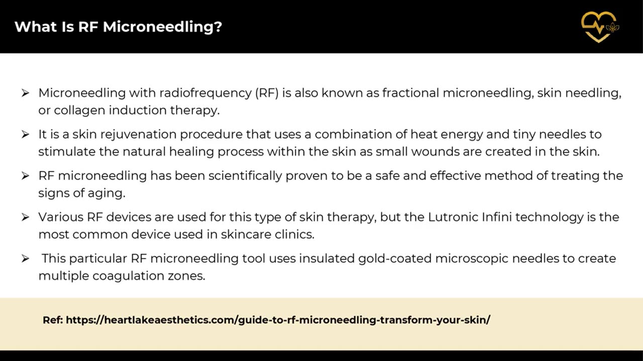 The Ultimate Guide to RF Microneedling: Transform Your Skin