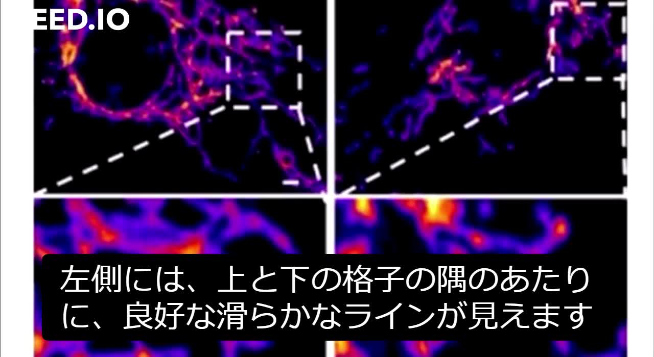ワクチンは、血管の内側に並ぶ細胞に損傷を与える