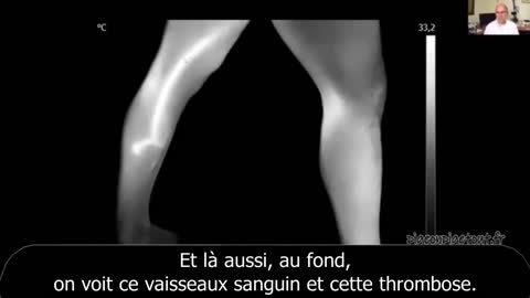 7 mn - Asymptomatiques, vous dites ? La bombe à retardement 27-09-2022