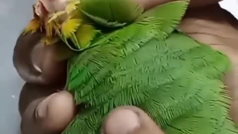 Parrot Neck Surgery