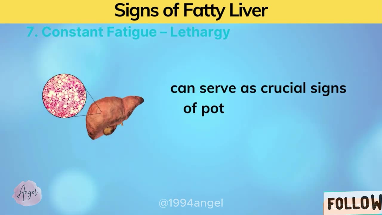 DON'T IGNORE! These 8 Early Signs of Fatty Liver