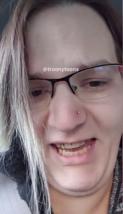 'Loopy As F**k' Biological Male Cries Tears Of Joy Over His New Cleavage From Breast Implants