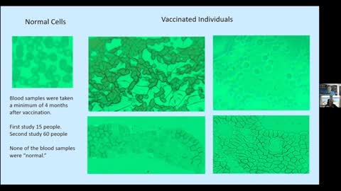 Vax and shedding side effects on the blood and what you can naturally do to reverse effects