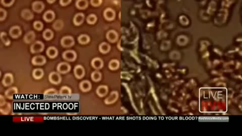 Stew Peters Show Revealing Blood Smears of Vaccinated Persons