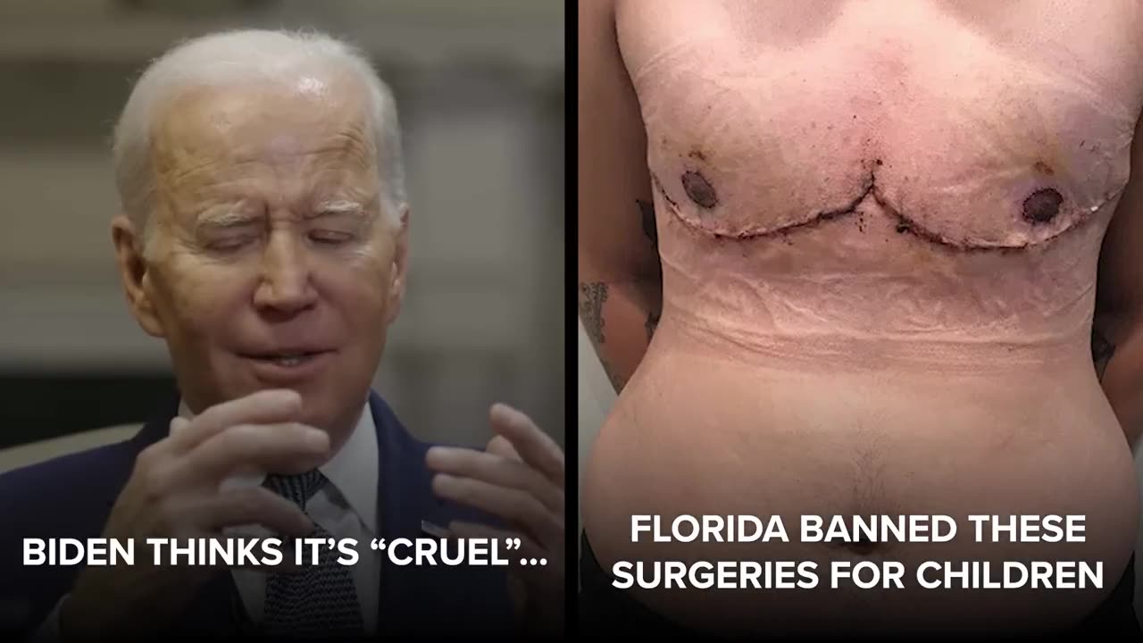 GRAPHIC WARNING: Biden thinks it’s “cruel” that Florida is not allowing sex change for kids