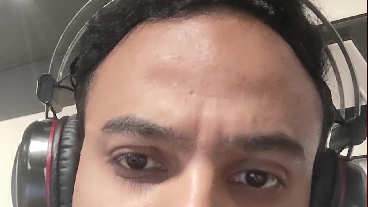 Viral