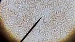 UNVAXXED VS VAXXED ( MURDERNA ) BLOOD !!