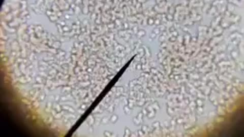 UNVAXXED VS VAXXED ( MURDERNA ) BLOOD !!