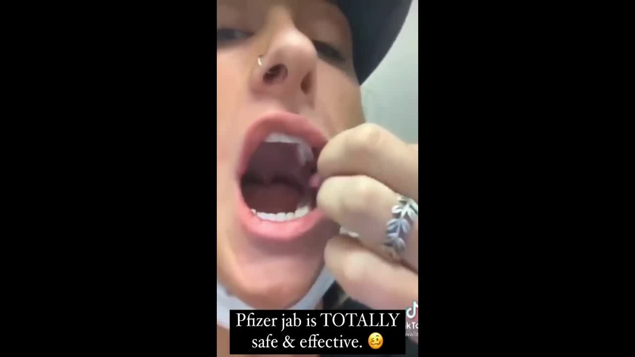 Lady has huge busted blood vessels after getting vaccine.