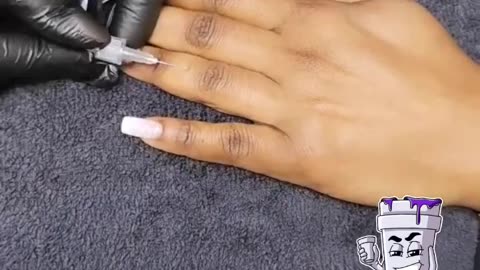 Hand Fillers