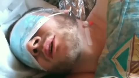 Severely Injured Russian Say Not to Believe Putin's Lies