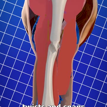 Dangers Of Arm Wrestling 😬