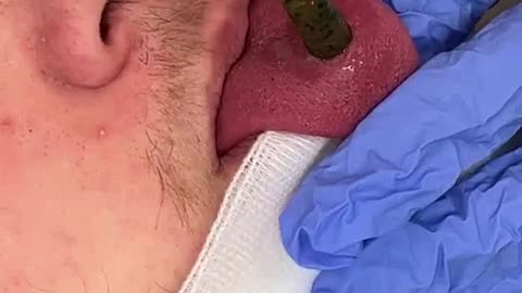 This came out of his tongue...