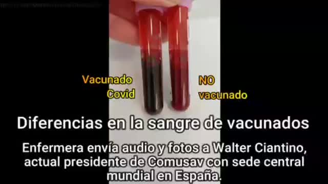 SANGRE VACUNADO VS NO VACUNADO