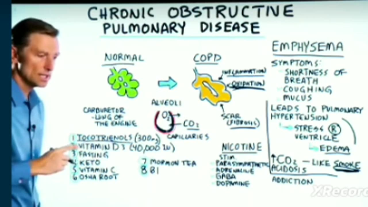 Treating COPD