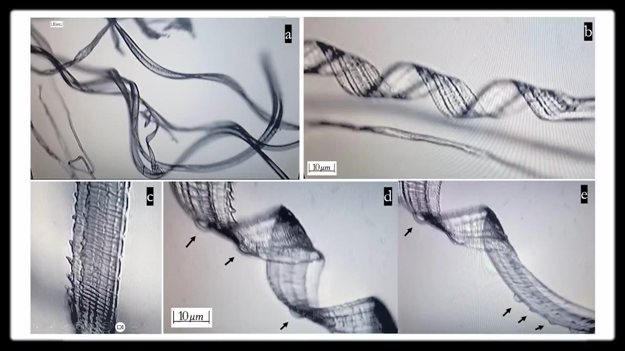 Self-assembly nanoparticles Found in the bodies of the jabbed #UCNYNEWS