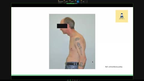 ST5.55 year old man with SOB