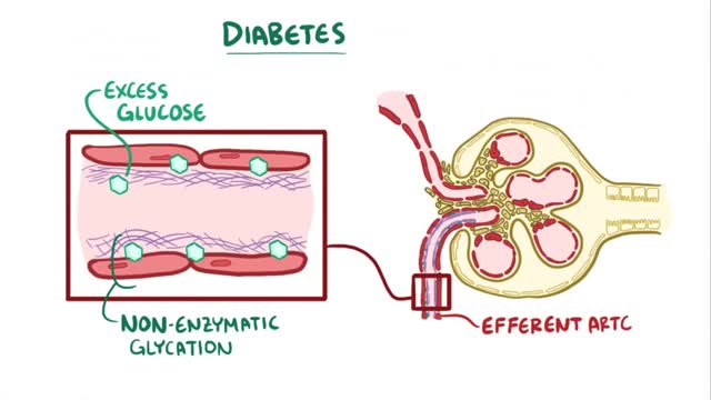 Chronic kidney disease - causes- symptoms- diagnosis- treatment- pathology