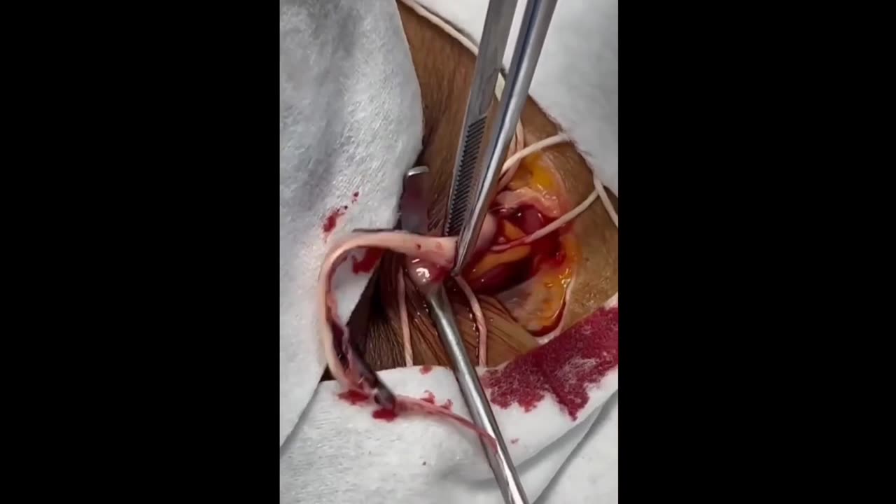 Did you get Vaxed ?