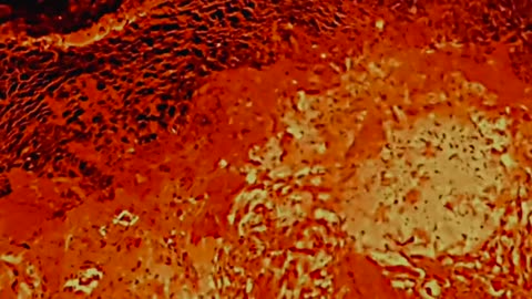 Rolling in the Deep..