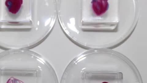 The first 3D printed Heart using the patient’s own cells