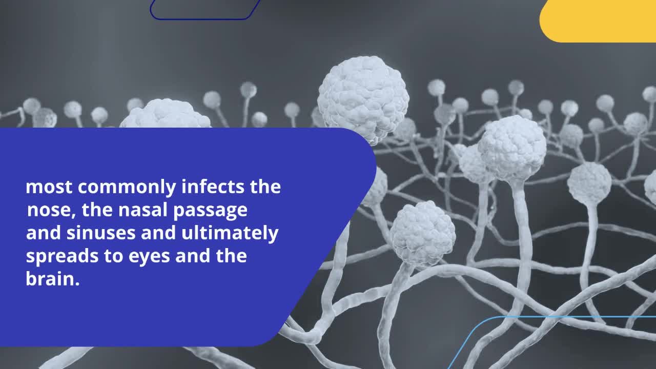 Mucormycosis in cancer patients - an emerging threat