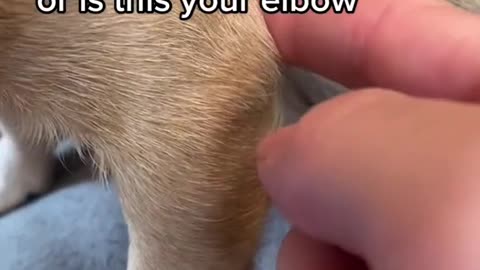 Is this your elbow