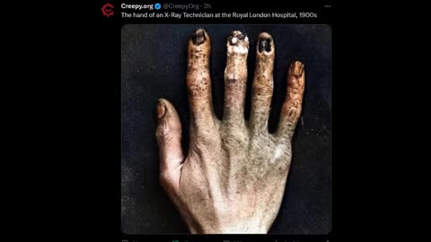 Creepy - hand of a X-ray tech
