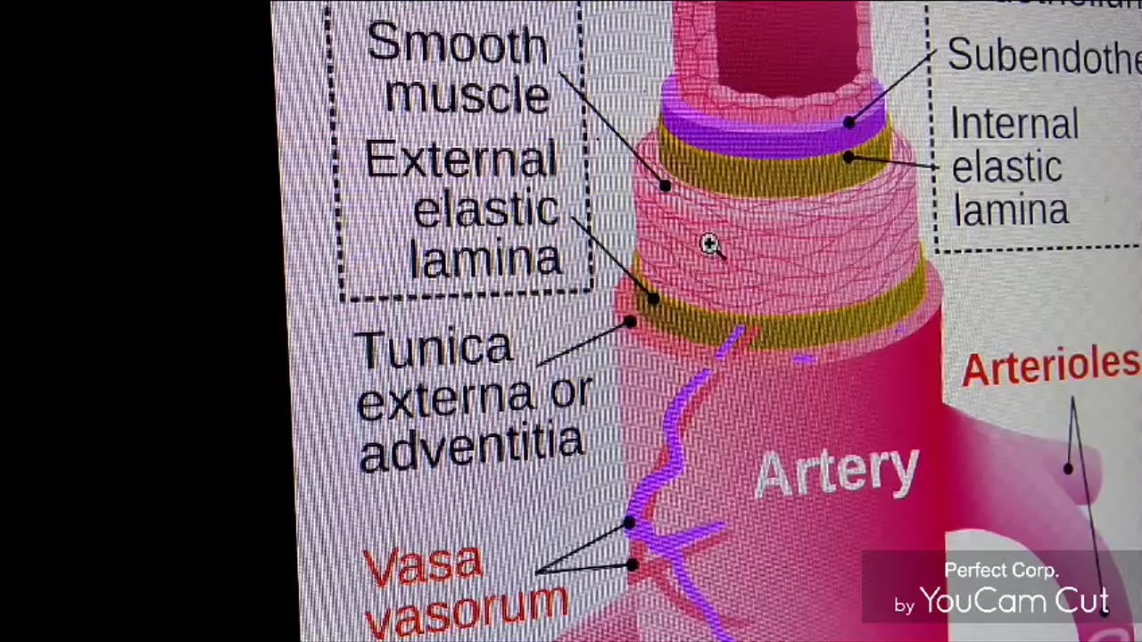 Can an aneurysm be prevented?