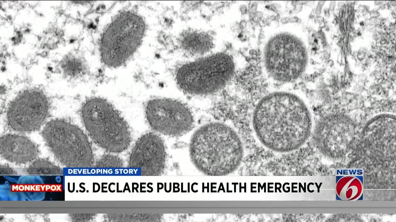 US declares public health emergency over monkeypox outbreak