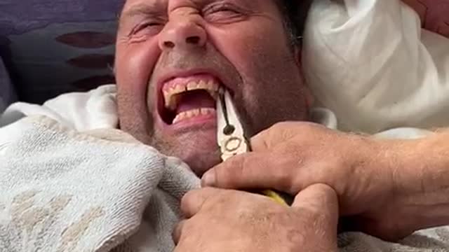 Man Pulls His Buddy's Loose Tooth Out During Quarantine