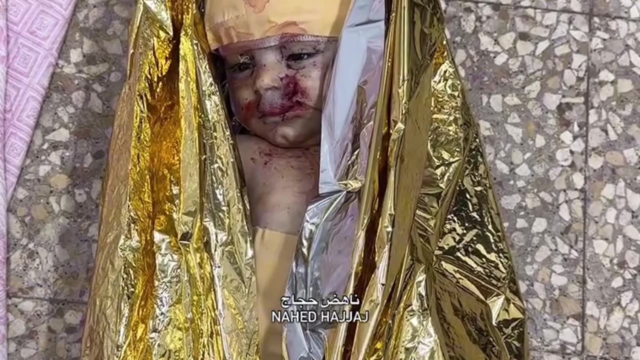 The child, Karam Nofal, 6 months old, was recently martyred in an Israeli bombing (Graphic)