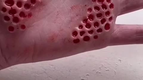 SFX trypophobia removal