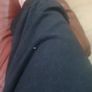 Tiny beatle Insect crawling down my leg to my foot 😅